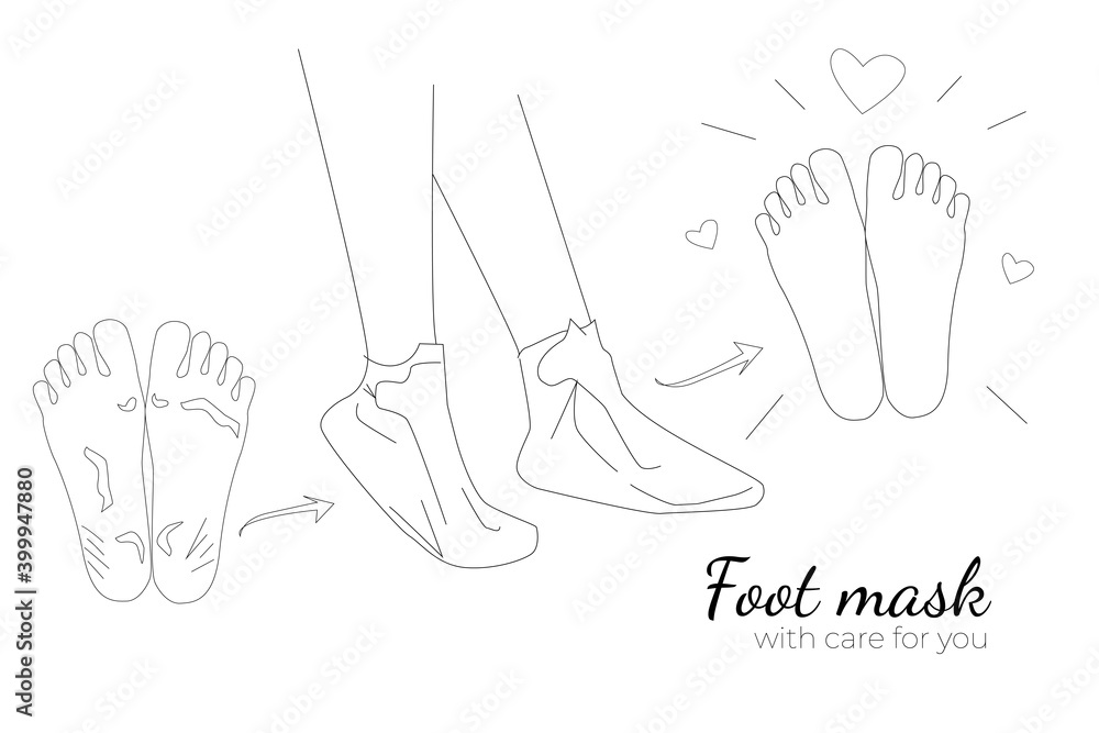 Vetor de Foot mask. The process of applying a foot mask. Before and
