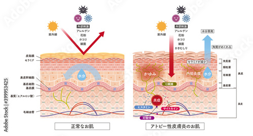 Cross section of the skin 3 front