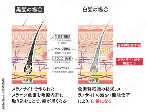 Cross section of the skin 12 front