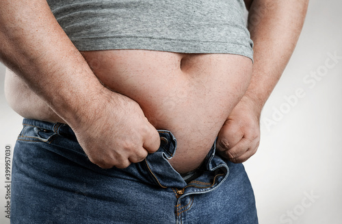 Obesity concept, close up of overweight man trying to wear too small jeans photo