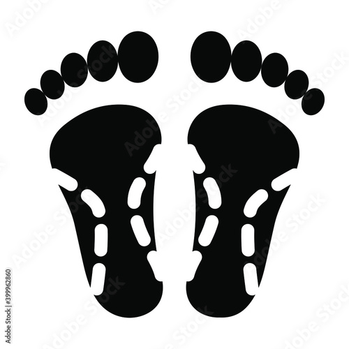 
Trendy solid icon of feet surgery
