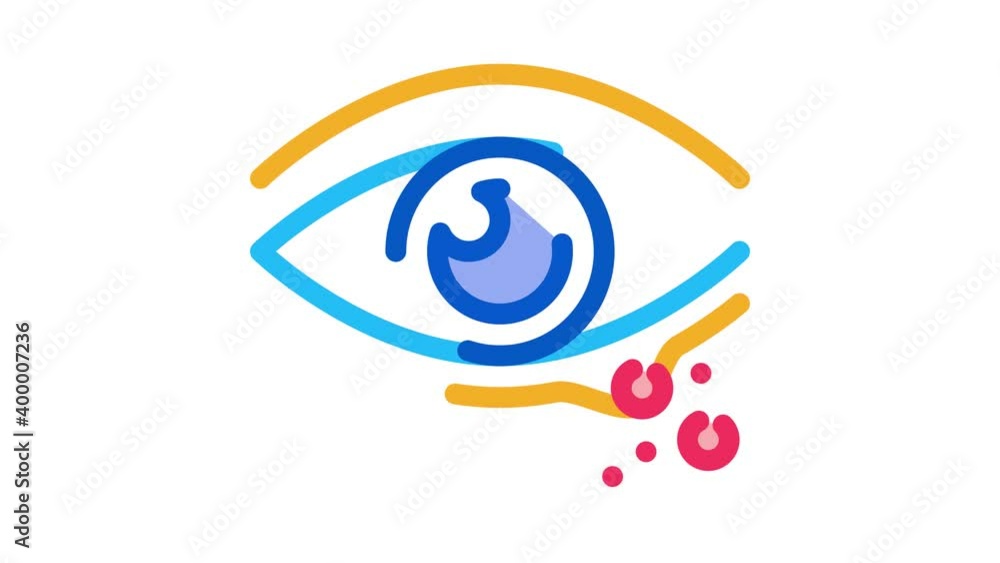 Eye Rash Stick Figure rash near eye Icon Animation. color rash near eye animated icon on ...