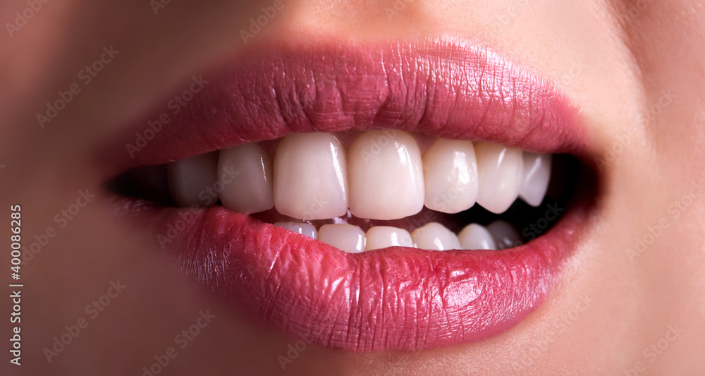 Perfect Close Up Sensual beautiful sexy Seductive Pink Lips woman smile with tongue . White Teeth bleaching ceramic crowns whitening young lady. Dental zircon implants restoration surgery Perfect Close Up Sensual beautiful sexy Seductive Pink Lips woman smile with tongue . White Teeth bleaching ceramic crowns whitening young lady. Dental zircon implants restoration surgery