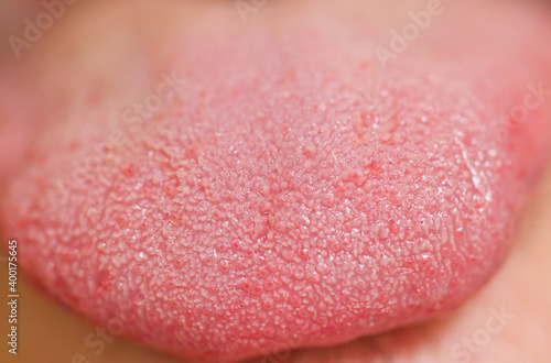 tongue photo