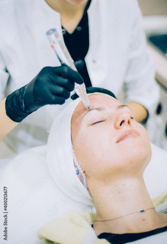 young woman with problem skin receiving mesotherapy facial treatment in beauty clinic young woman with problem skin receiving mesotherapy facial treatment in beauty clinic