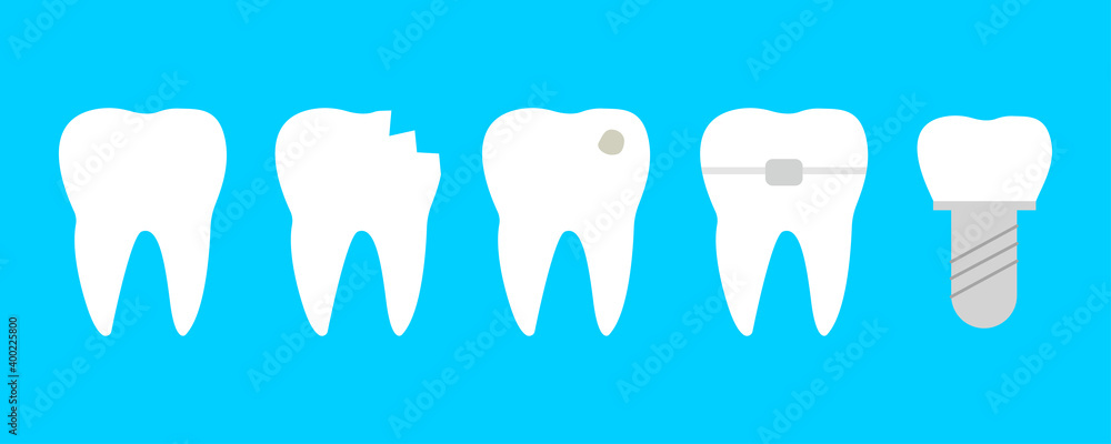 Teeth set with different diseases. Healthy tooth, cracked, brocken, with caries, orthodontic braces and dental implant Teeth set with different diseases. Healthy tooth, cracked, brocken, with caries, orthodontic braces and dental implant
