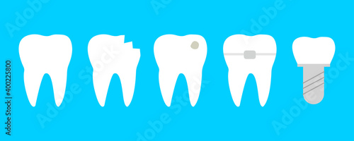 Teeth set with different diseases. Healthy tooth, cracked, brocken, with caries, orthodontic braces and dental implant