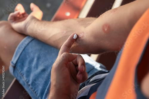 Man applying insect repellent cream on his arm outdoors, closeup
