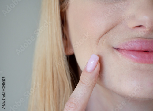 
the girl has wrinkles around her mouth photo