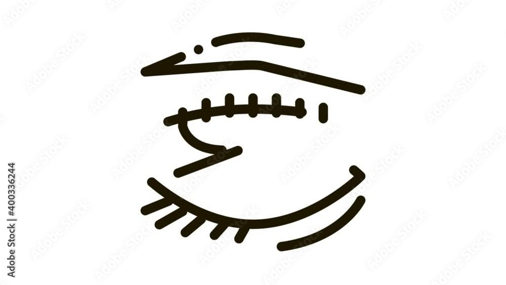 eyelid surgery stitching Icon Animation. black eyelid surgery stitching animated icon on white background eyelid surgery stitching Icon Animation. black eyelid surgery stitching animated icon on white background