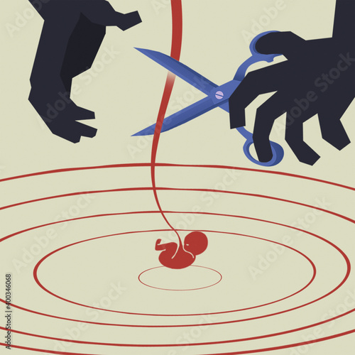 Abstract flat illustration depicting termination of pregnancy, abortion, scissors in hand cut the baby's umbilical cord