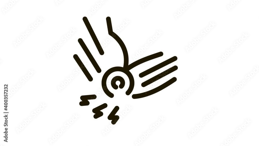 arthritis of elbow Icon Animation. black arthritis of elbow animated icon on white background arthritis of elbow Icon Animation. black arthritis of elbow animated icon on white background