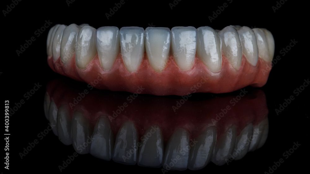 dental prosthesis of the lower jaw made of high quality ceramic on a black background dental prosthesis of the lower jaw made of high quality ceramic on a black background