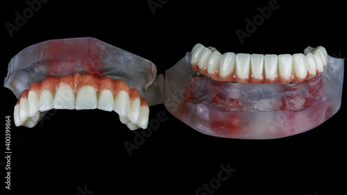 two dental prostheses for both jaws with artificial gum on a black background