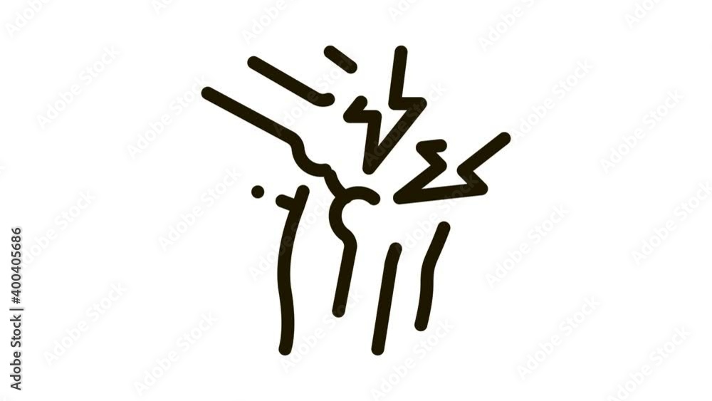 Knee Joint Pain Icon Animation. black Knee Joint Pain animated icon on white background Knee Joint Pain Icon Animation. black Knee Joint Pain animated icon on white background