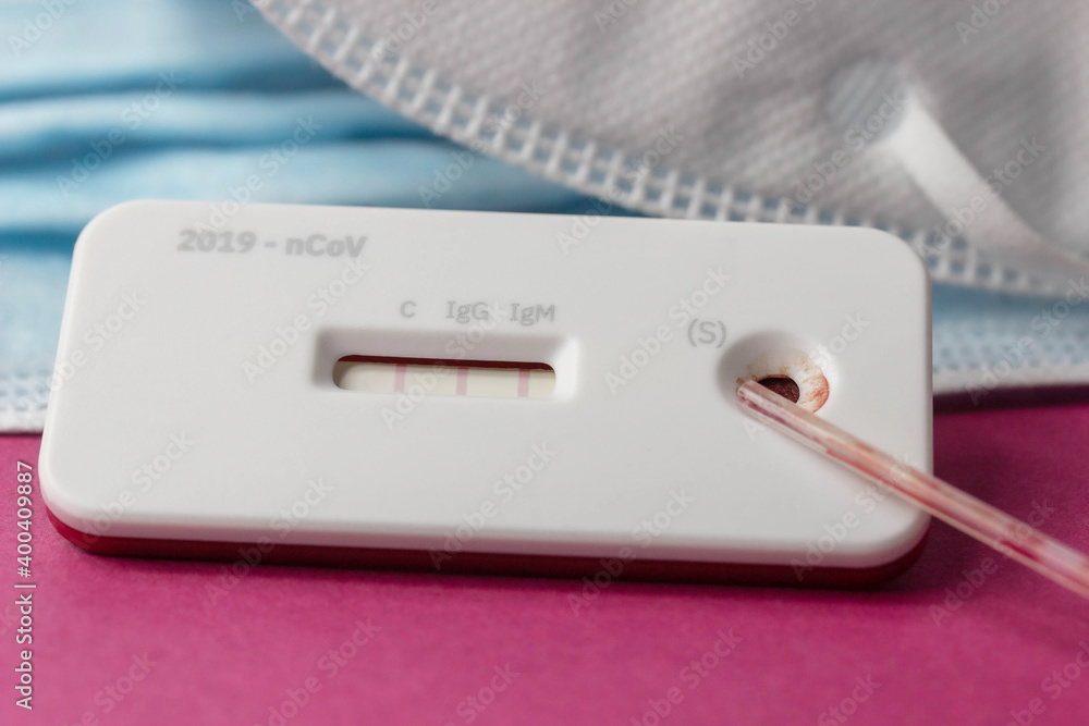 Antigen Test - Testung auf Antikörper Antigen Test - Testung auf Antikörper