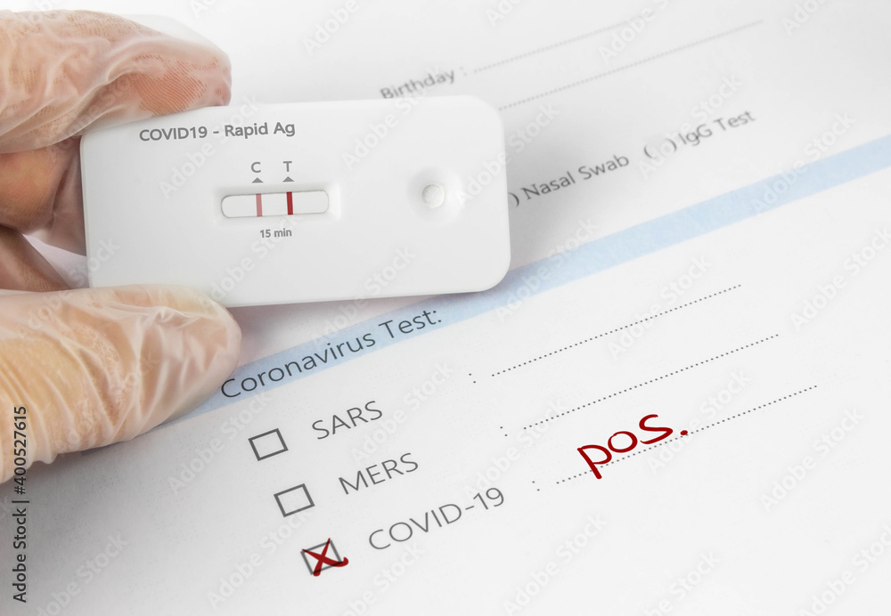 Unlocking the Power of Bild Corona Test: A Comprehensive Guide for Enhanced Health and Well-being