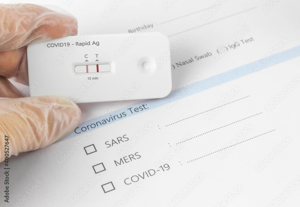 Schnelltest auf Corona Infektion Schnelltest auf Corona Infektion