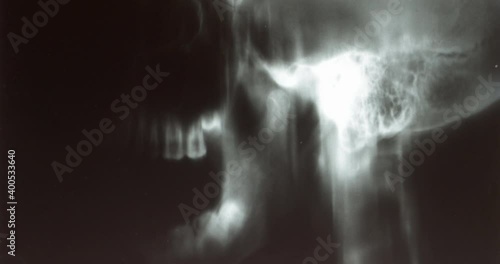 Stop motion x-rays of a lateral human skull as it opens and closes its mouth. 4K horror background