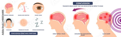 Brain Injury mild post head bleed sport loss second bump blow jolt hit skull ear contact hockey trauma fall pain athlete ball  rugby play 