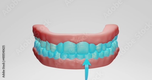 3d animation of neon mesh protection of stylized teeth, mouth, getting rid of yellow plaque, harmful bacteria, tartar, caries development, teeth whitening. bacteria attack tooth enamel photo