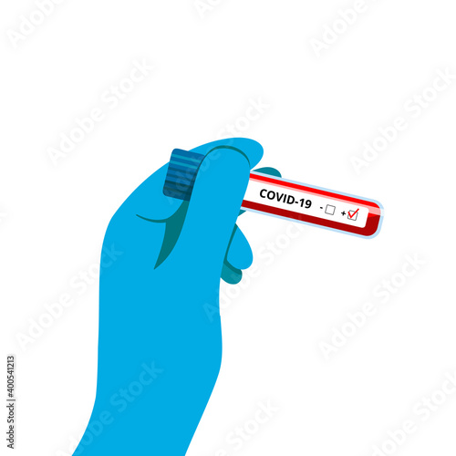 A hand in a blue medical glove holds a test tube with a positive blood test result for Coronavirus 2019 ncov. A positive test for a new Coronavirus infection. COVID 19 test. Vector illustration