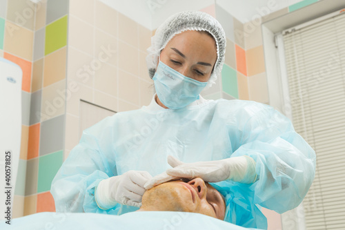Woman doctor makes mesothreads and thread lifting patient to man Cosmetic procedure 