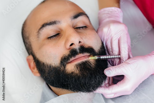 Cosmetic procedure for lip augmentation and wrinkle removal for a bearded man. Cosmetology photo