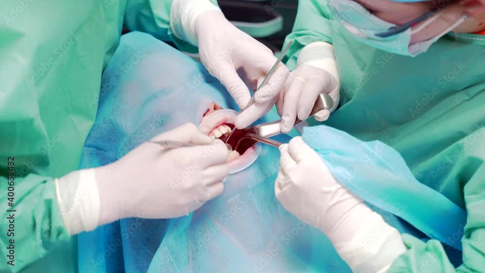 close up a team of dental surgeons performs surgery on a tooth. in a modern dental clinic. Top View. dentists examine the patient teeth before surgery. close up a team of dental surgeons performs surgery on a tooth. in a modern dental clinic. Top View. dentists examine the patient teeth before surgery.