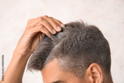 Man with graying hair on li...