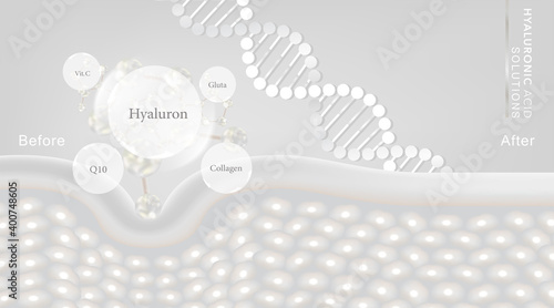Hyaluronic acid before and after skin solutions ad, white collagen serum drop with cosmetic advertising background ready to use, illustration vector.	