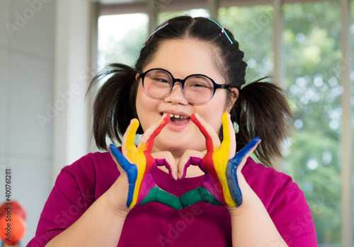 Portrait of Asian disabled child kid complex genetic disorders down syndrome girl with colorful painted hands photo