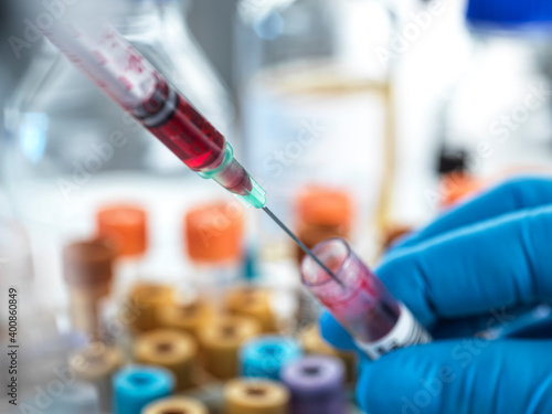 Biomedical scientist working with blood sample at laboratory photo