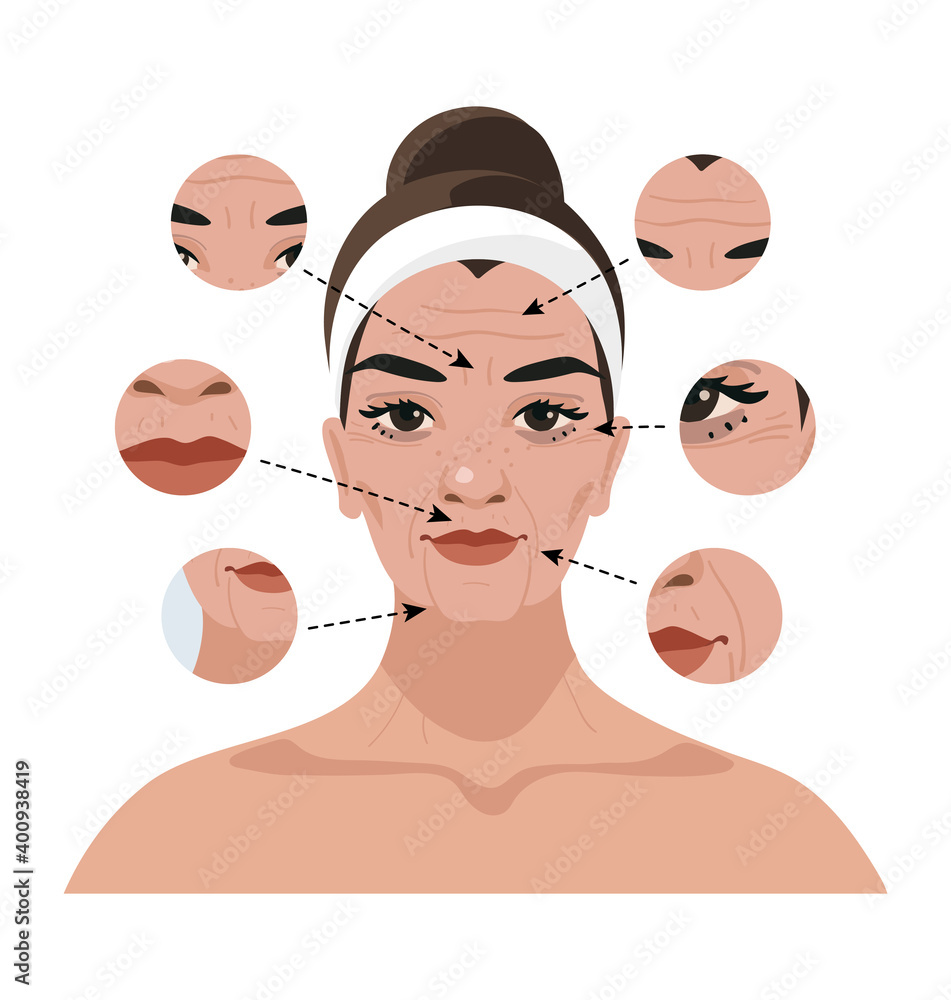 Portrait of a woman with age-related changes on the face and wrinkles. Illustration for a beauty salon, cosmetic procedures, injections, plastic surgery. Flat vector illustration Portrait of a woman with age-related changes on the face and wrinkles. Illustration for a beauty salon, cosmetic procedures, injections, plastic surgery. Flat vector illustration