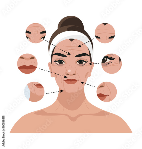 Portrait of a woman with age-related changes on the face and wrinkles. Illustration for a beauty salon, cosmetic procedures, injections, plastic surgery. Flat vector illustration