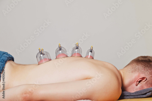 Close-up for multiple vacuum cups, medical cupping therapy on human body. Doctor with cups for patient, therapy. Wellness, health injury rehabilitation concept. Alternative medicine. Copy space photo