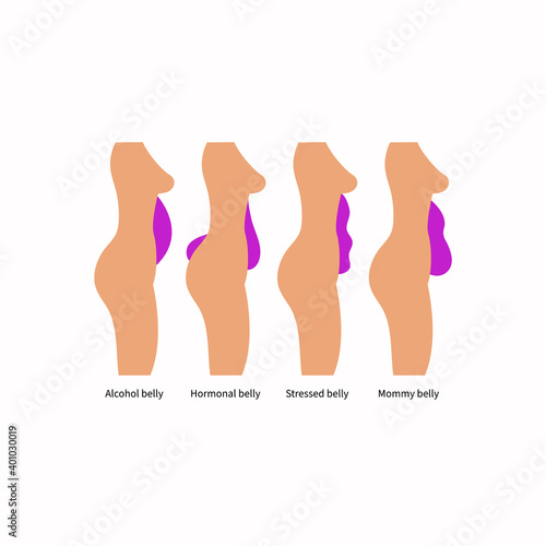 Different types and causes of abdominal obesity in women