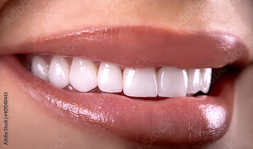 Perfect Close Up Sensual beautiful sexy Seductive Pink Lips woman smile with tongue . White Teeth bleaching ceramic crowns whitening young lady. Dental zircon implants restoration surgery