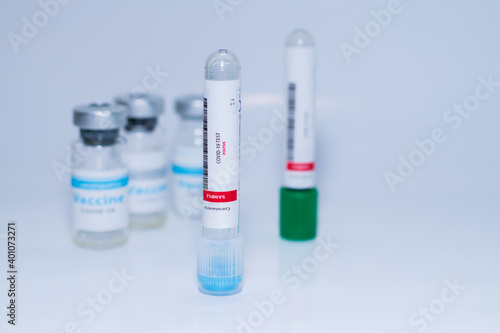 Testing for presence of coronavirus. Tube containing a swab sample that has tested positive for COVID-19. A single bottle vial of Covid-19 coronavirus vaccine in a research medical lab. 