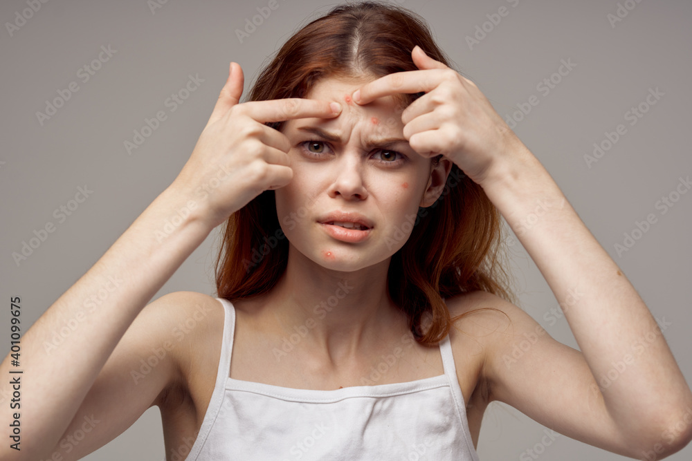 portrait of a woman squeezes a pimple on her forehead acne cosmetology dermatology portrait of a woman squeezes a pimple on her forehead acne cosmetology dermatology