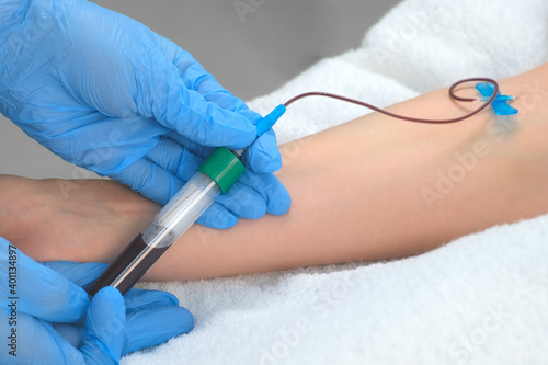 Laboratory worker doctor takes a blood sample for analysis, hand closeup. Blood sampling in the laboratory. Taking a blood in cosmetology clinic before PRP therapy procedure.