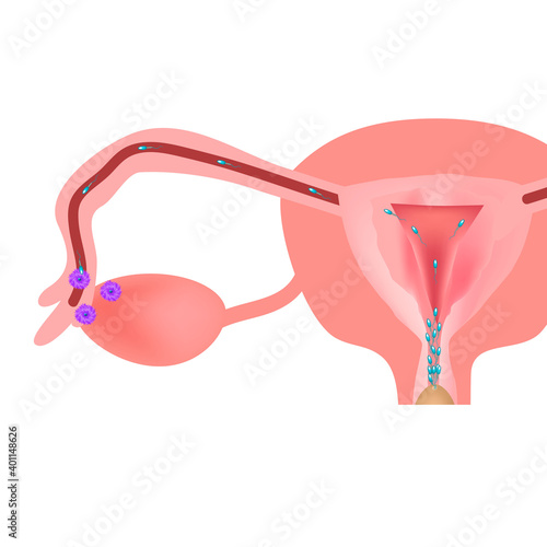 Fertilization of an egg with sperm. Ejaculation into the genital tract. Vector illustration on isolated background