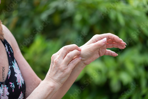 Woman scratching her hand