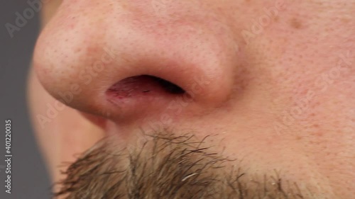 man picks his left nostril, scratches his itchy nose, loss of smell, close-up side view