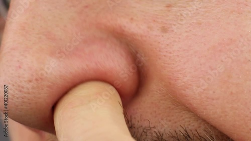 man clean up or picks his right nostril, scratches his itchy nose, loss of smell, close-up side view