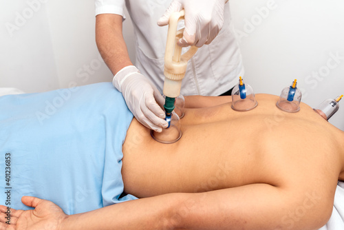 Physiotherapist Applying Cupping Techniques