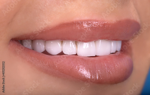 Perfect Close Up Sensual beautiful sexy Seductive Pink  Lips woman smile with tongue . White Teeth bleaching ceramic crowns whitening young lady. Dental zircon implants restoration surgery