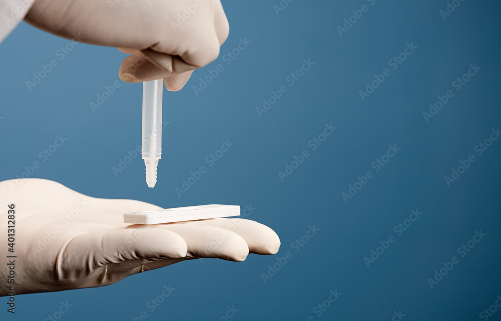 Laboratory Scientist Performing RDT Rapid Diagnostic Test For Antibodies To Detect Presence Of