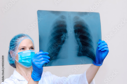 Woman doctor with lung x-ray  fluorography  x-ray on light background. A female doctor in a medical uniform  coat . Medical staff  medicine concept. Pneumonia. close-up