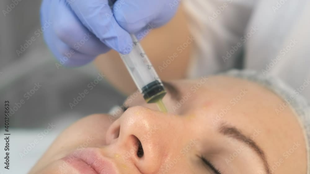 Beautician is making cure procedure on patient's face. Cosmetologist is applying yellow peeling on woman's face in beauty clinic. Doctor drops medicine on woman's nose and forehead from a syringe. Beautician is making cure procedure on patient's face. Cosmetologist is applying yellow peeling on woman's face in beauty clinic. Doctor drops medicine on woman's nose and forehead from a syringe.